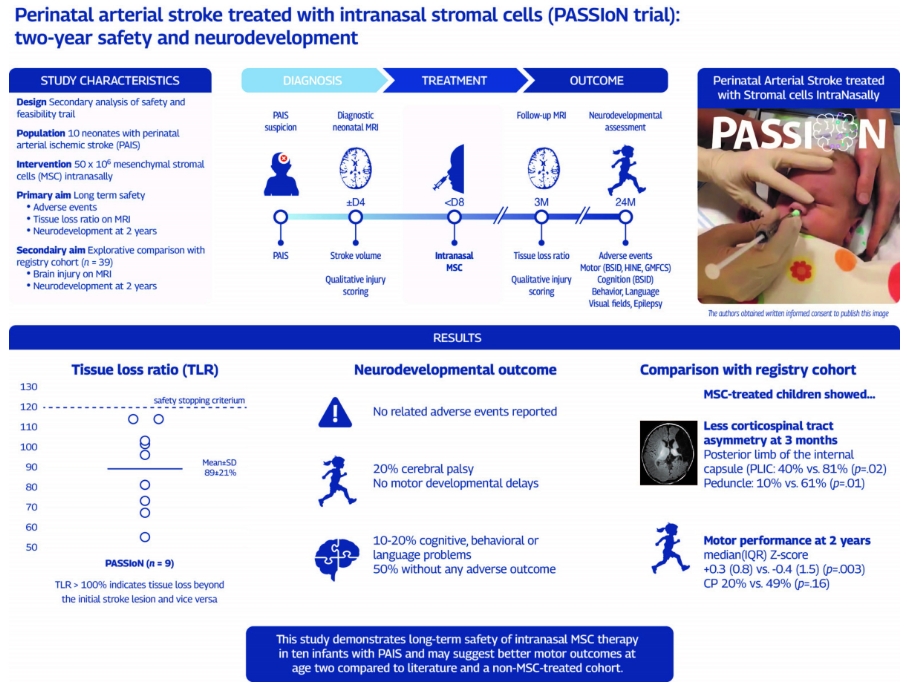 經鼻給藥干細胞療法突破：新生兒卒中后腦癱風險直降50%！2年安全追蹤