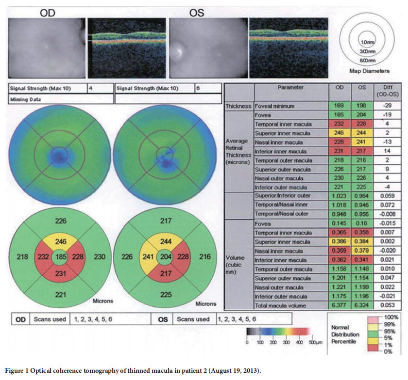 遺傳性視神經(jīng)病變臨床試驗(yàn)