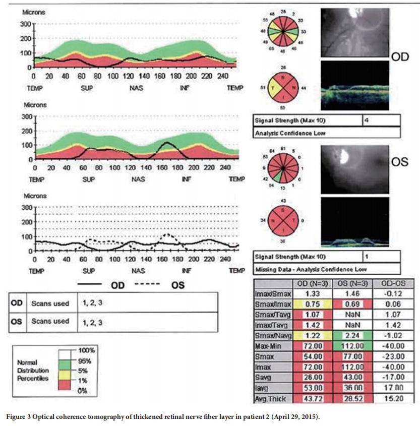遺傳性視神經(jīng)病變臨床試驗(yàn)