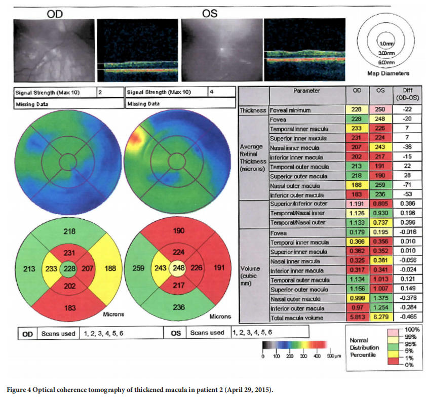 遺傳性視神經(jīng)病變臨床試驗(yàn)