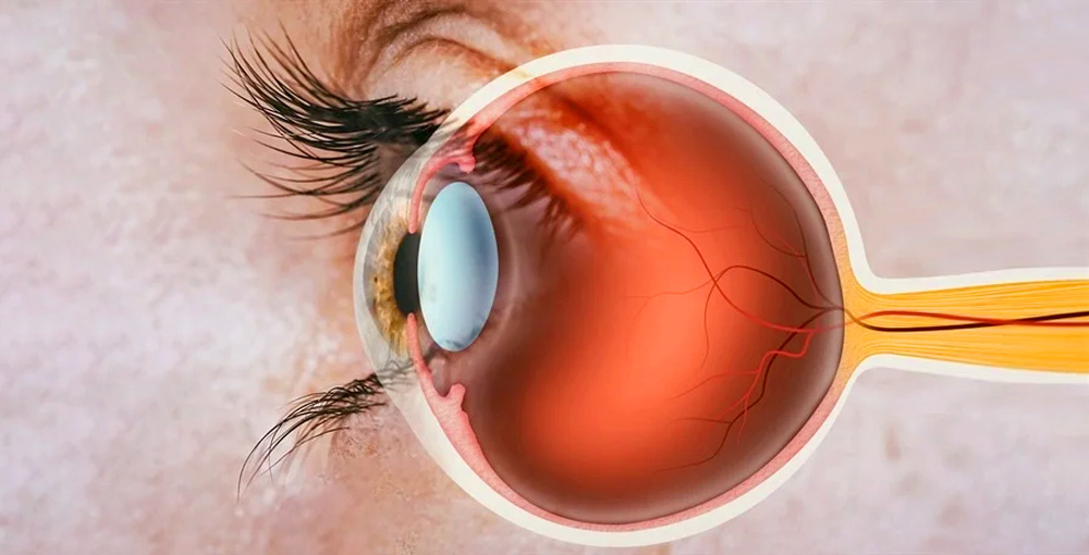 視神經疾病 視神經疾病