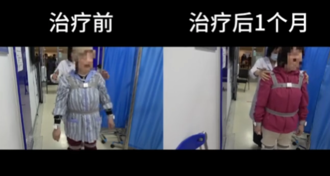 沈女士康復過程