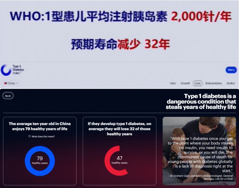 2025|間充質干細胞療法治療1型糖尿病:現狀與臨床進展 2025|間充質干細胞療法治療1型糖尿病:現狀與臨床進展