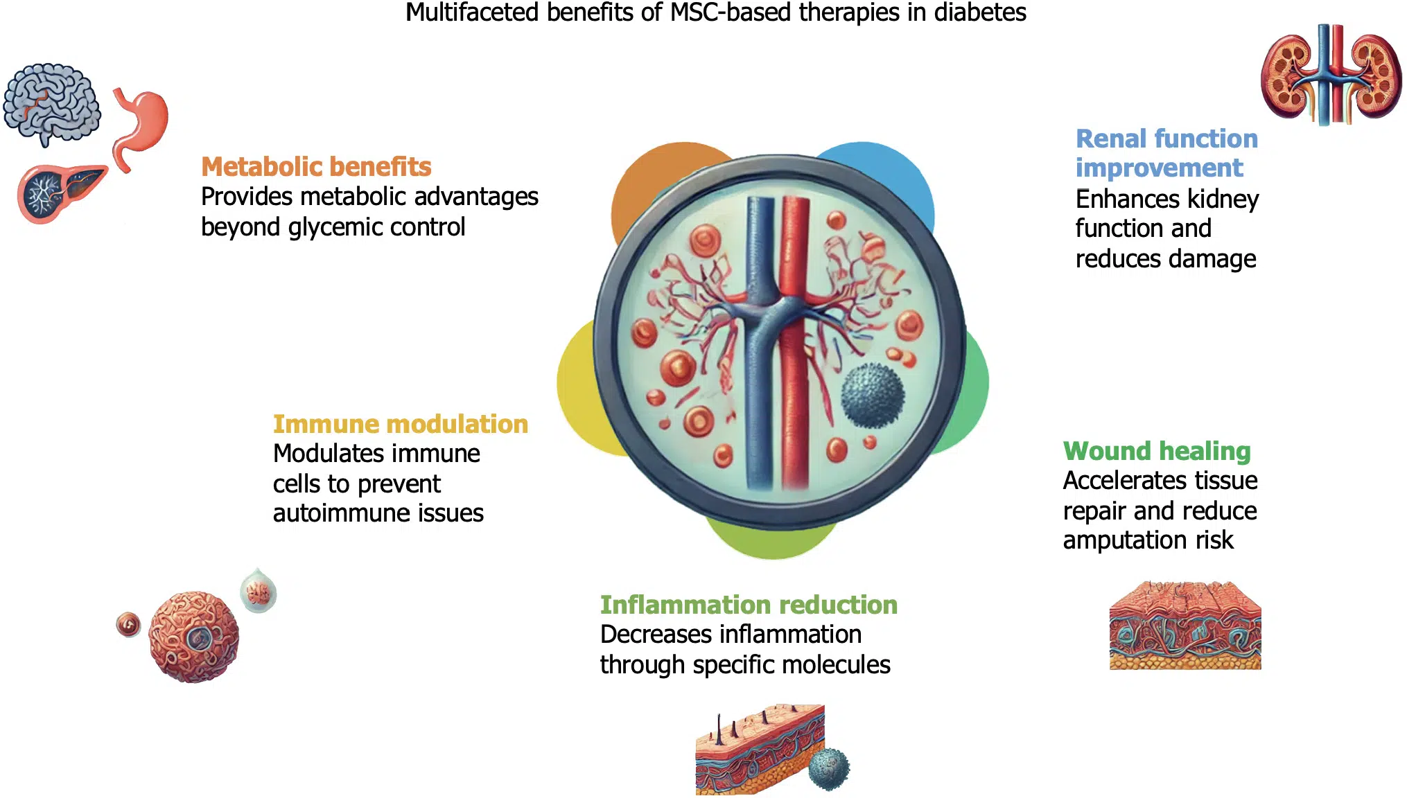 基于間充質(zhì)干細(xì)胞的療法對(duì)糖尿病患者的各種非血糖效應(yīng)