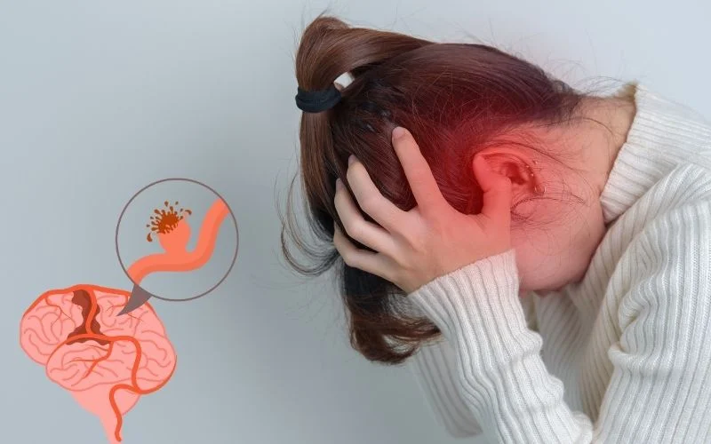 神經干細胞移植治療腦出血：機制、療效與轉化前景