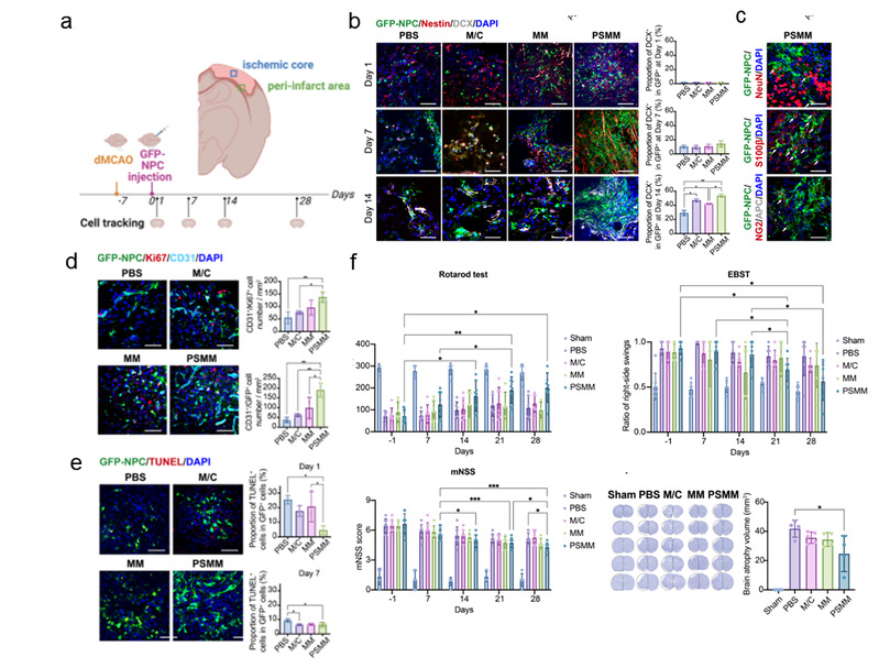 負載NPCs的PSMM-基質復合支架促進大鼠卒中后損傷修復