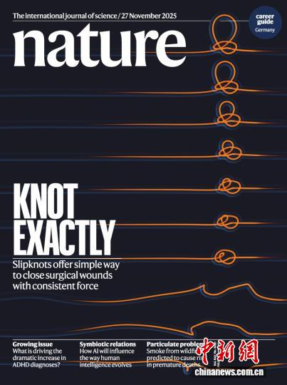研究成果發(fā)表于國際頂級期刊《自然》并登上雜志封面。研究團隊供圖