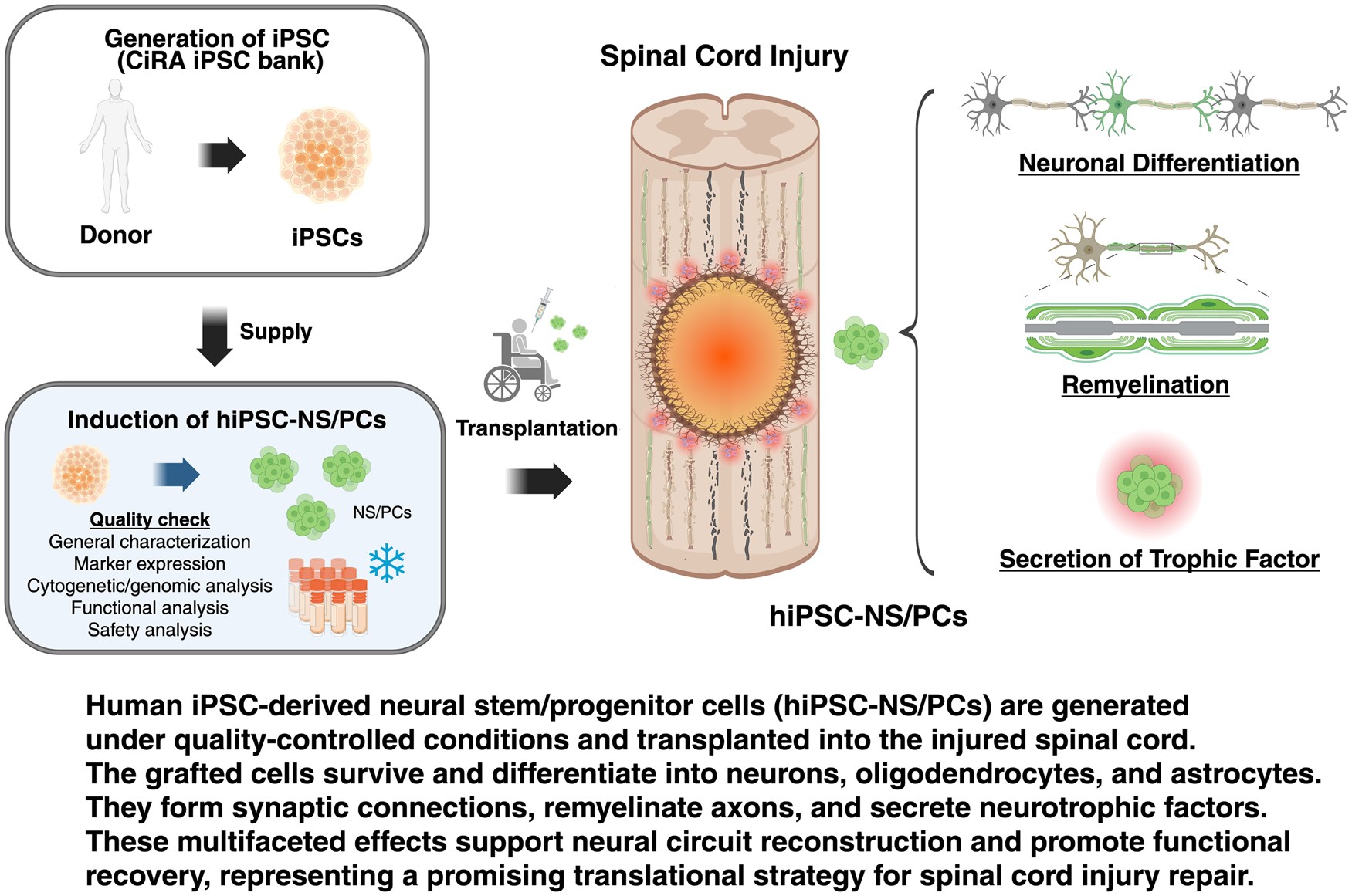 最新綜述！多能干細胞來源的神經干/祖細胞療法治療脊髓損傷：臨床進展和轉化展望